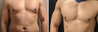 5 feet 8 Male Progress Pics of 33 lbs Fat Loss 190 lbs to 157 lbs