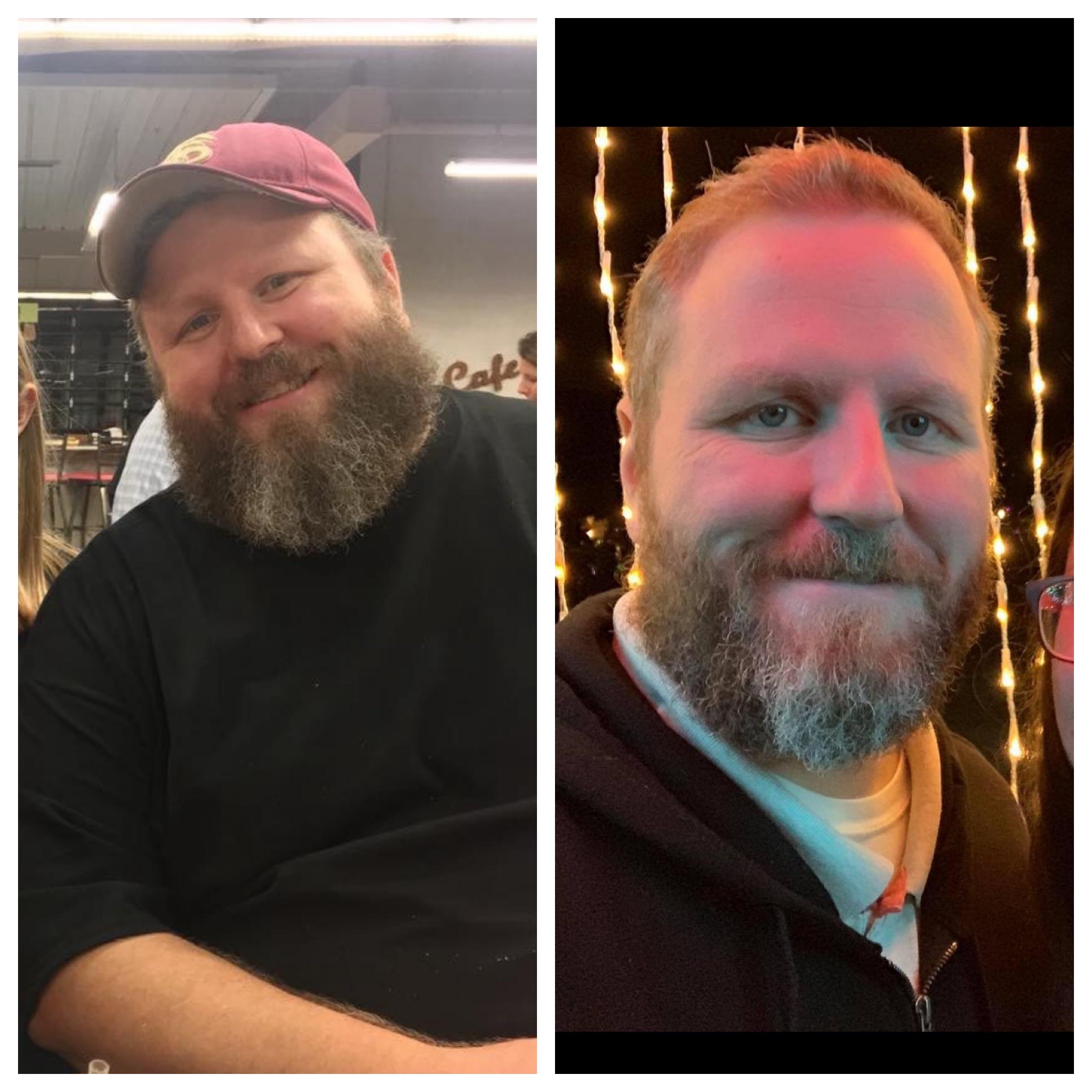 128 lbs Weight Loss 6 foot Male 387 lbs to 259 lbs