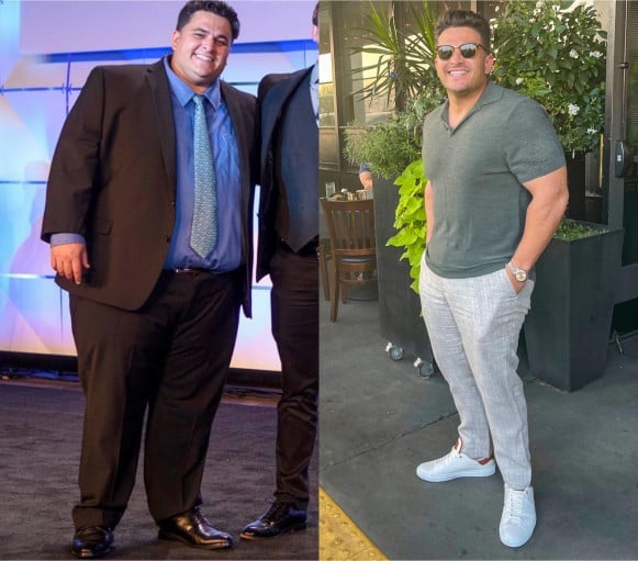A before and after photo of a 5'9" male showing a weight reduction from 400 pounds to 220 pounds. A total loss of 180 pounds.