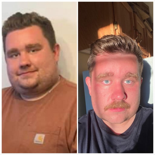 A before and after photo of a 5'7" male showing a weight reduction from 285 pounds to 227 pounds. A net loss of 58 pounds.