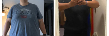 6 foot Male 100 lbs Weight Loss Before and After 423 lbs to 323 lbs