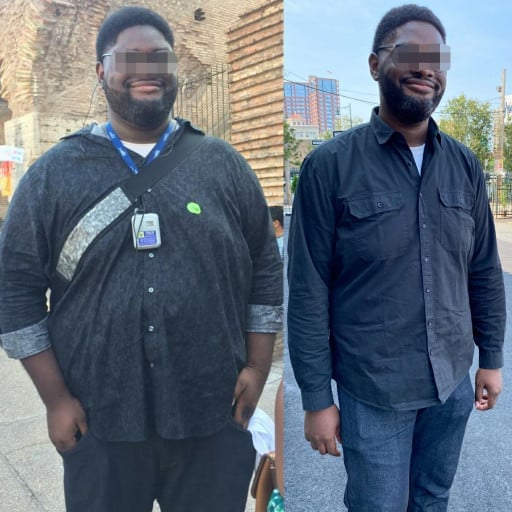 A before and after photo of a 6'6" male showing a weight reduction from 439 pounds to 310 pounds. A net loss of 129 pounds.