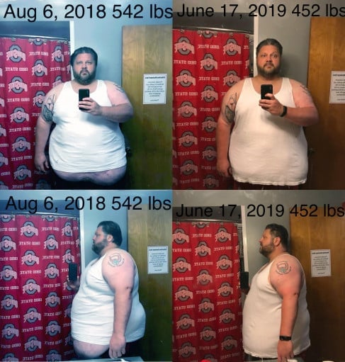 A progress pic of a person at 452 lbs