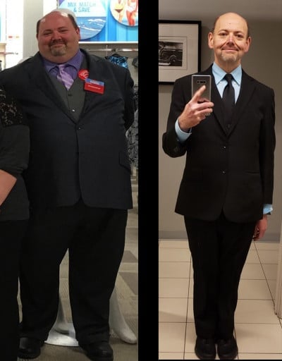 A before and after photo of a 5'10" male showing a weight reduction from 418 pounds to 171 pounds. A net loss of 247 pounds.