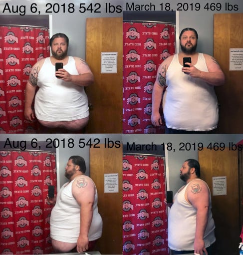 6 foot 1 Male 73 lbs Fat Loss Before and After 542 lbs to 469 lbs