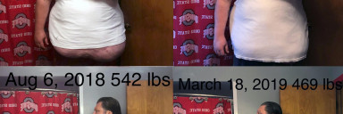 6 foot 1 Male 73 lbs Fat Loss Before and After 542 lbs to 469 lbs