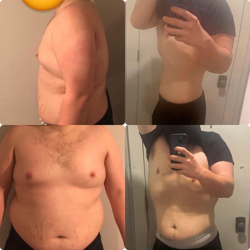 A before and after photo of a 6'1" male showing a weight reduction from 324 pounds to 222 pounds. A net loss of 102 pounds.