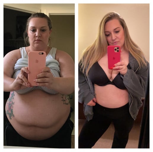 A photo of a 5'7" woman showing a weight cut from 310 pounds to 230 pounds. A total loss of 80 pounds.