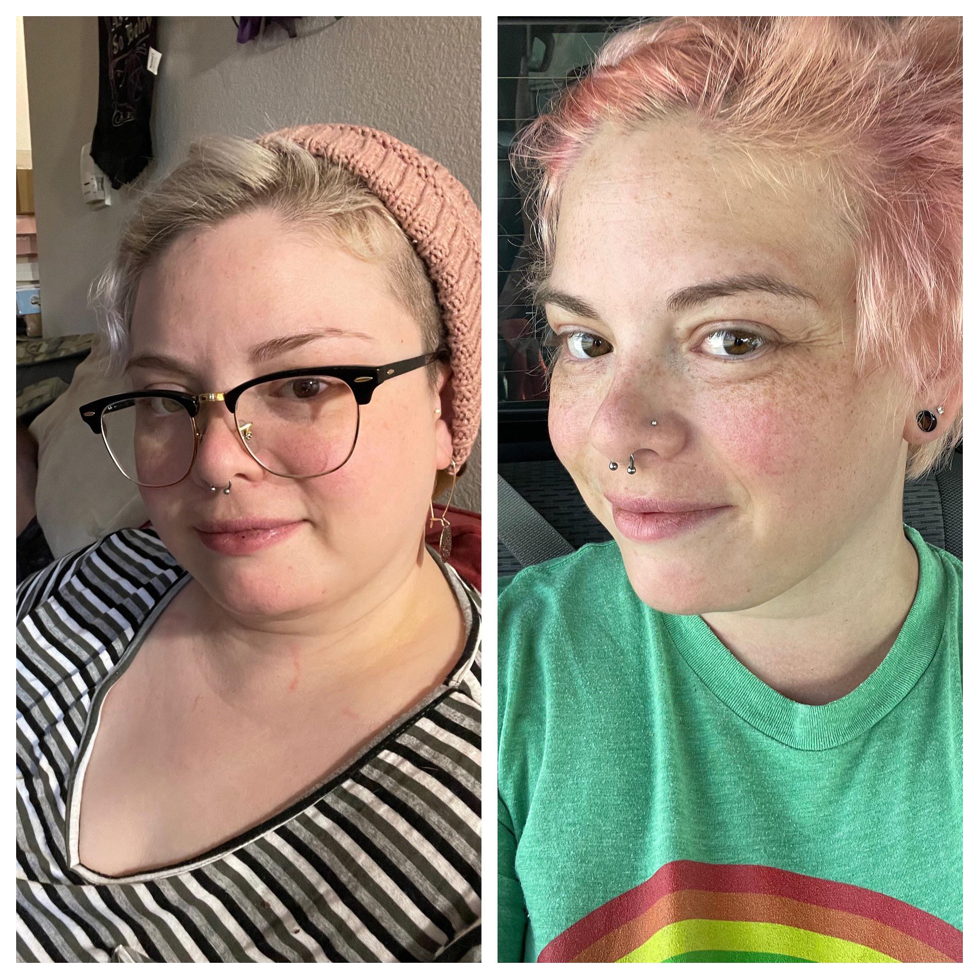 4 foot 11 Female Progress Pics of 28 lbs Fat Loss 198 lbs to 170 lbs