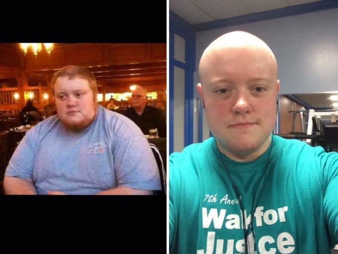 A before and after photo of a 5'9" male showing a weight cut from 395 pounds to 223 pounds. A net loss of 172 pounds.