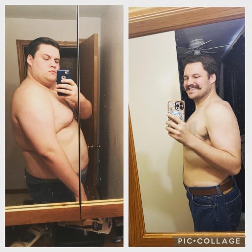 A progress pic of a 6'5" man showing a fat loss from 415 pounds to 259 pounds. A total loss of 156 pounds.