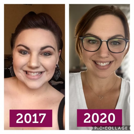 82 lbs Weight Loss Before and After 5 feet 6 Female 265 lbs to 183 lbs
