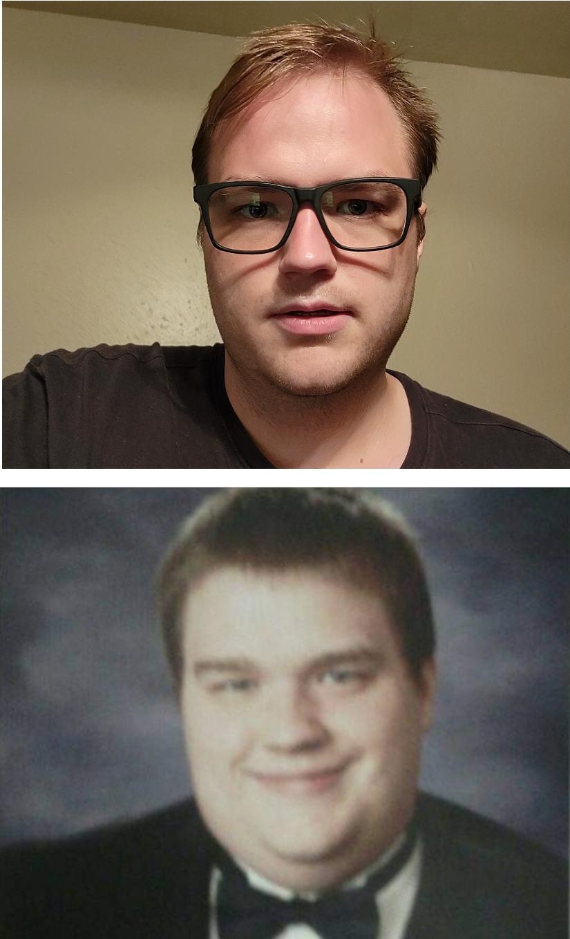 6 foot Male 75 lbs Weight Loss 335 lbs to 260 lbs