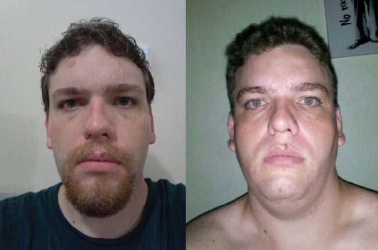 55 lbs Weight Loss Before and After 6'2 Male 352 lbs to 297 lbs