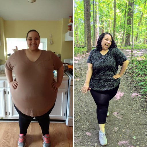 5 feet 3 Female Before and After 306 lbs Weight Loss 443 lbs to 137 lbs