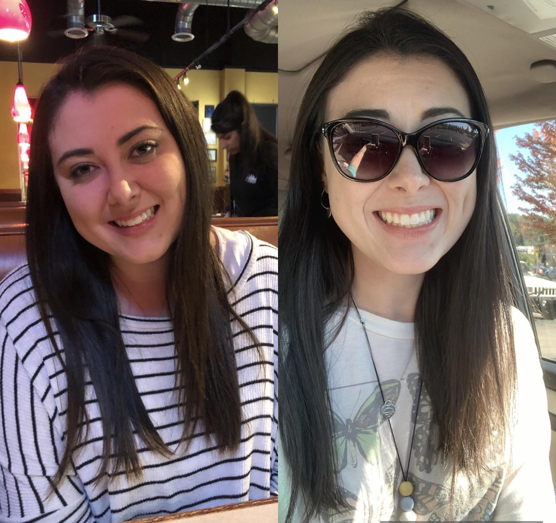 6 foot Female 110 lbs Weight Loss Before and After 278 lbs to 168 lbs