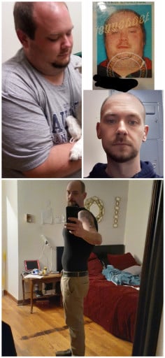 A picture of a 6'0" male showing a weight loss from 329 pounds to 159 pounds. A net loss of 170 pounds.