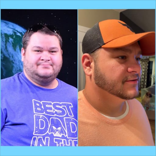 A progress pic of a 6'2" man showing a fat loss from 415 pounds to 335 pounds. A net loss of 80 pounds.
