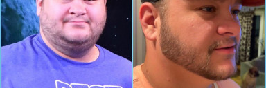 6 feet 2 Male Progress Pics of 80 lbs Fat Loss 415 lbs to 335 lbs