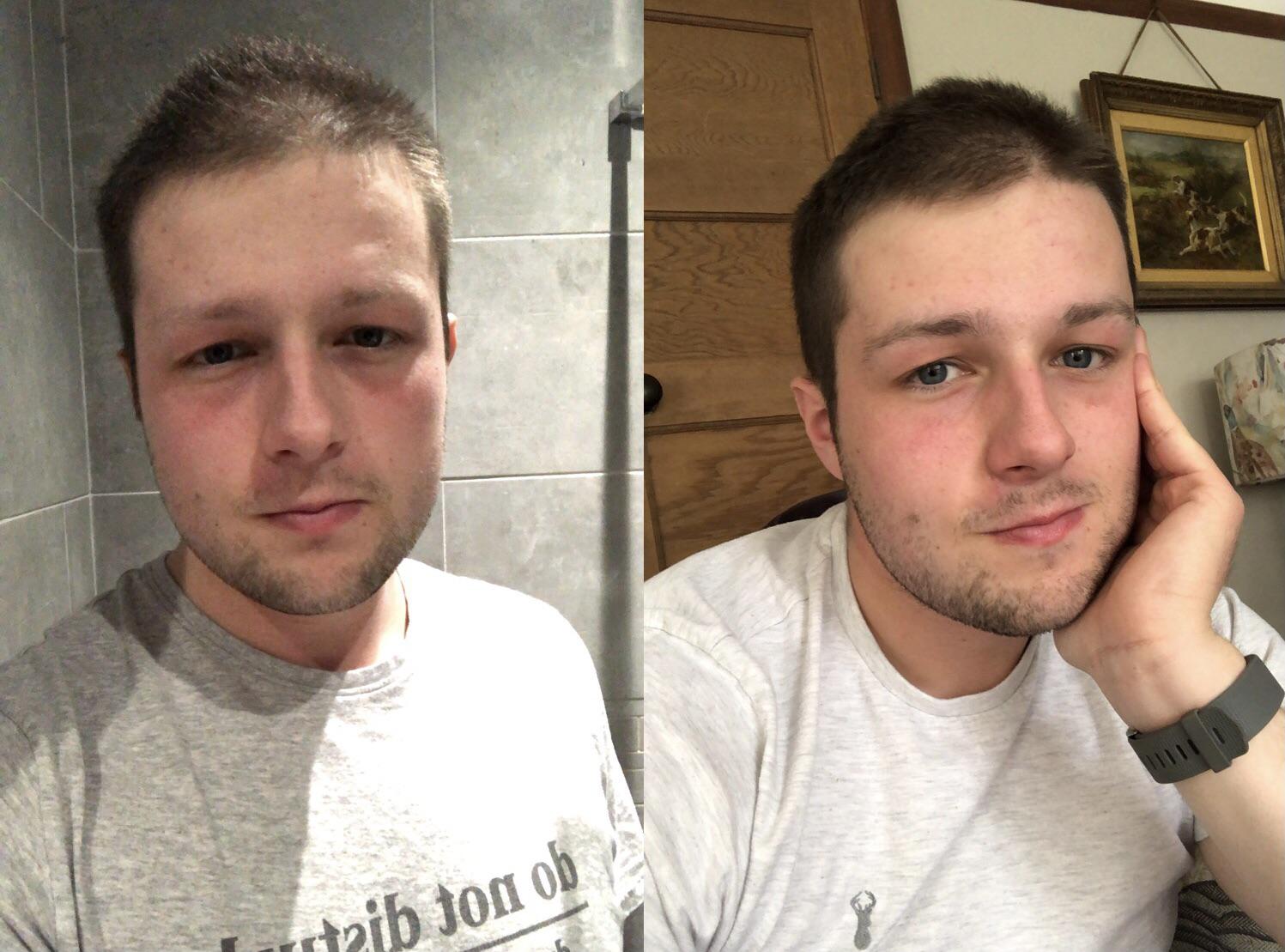 5'10 Male Progress Pics of 11 lbs Weight Loss 216 lbs to 205 lbs