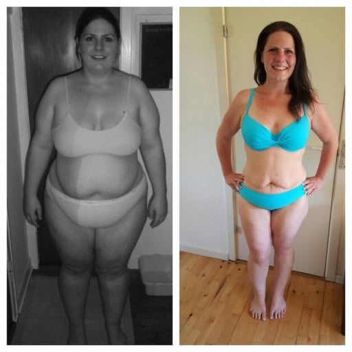 A before and after photo of a 5'7" female showing a weight reduction from 352 pounds to 202 pounds. A net loss of 150 pounds.