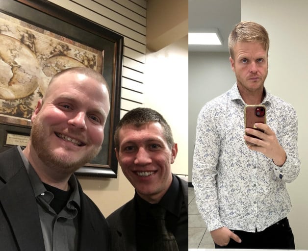 5 foot 10 Male Before and After 95 lbs Weight Loss 280 lbs to 185 lbs