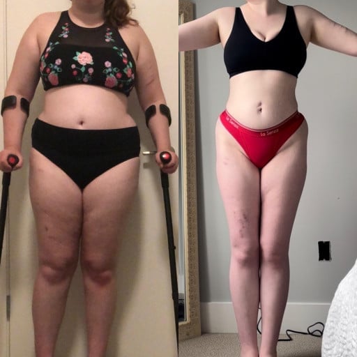5'7 Female 67 lbs Weight Loss Before and After 230 lbs to 163 lbs