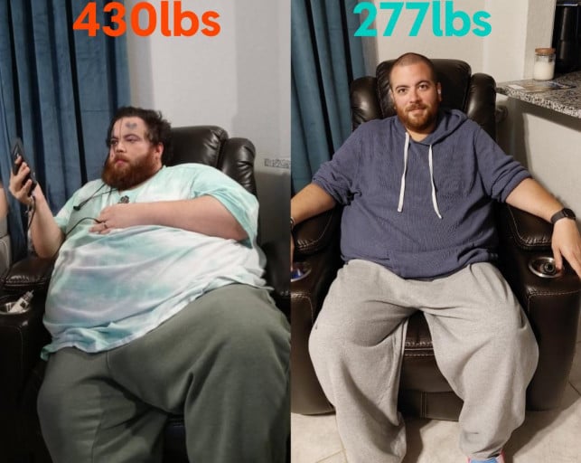 A picture of a 5'10" male showing a weight loss from 430 pounds to 277 pounds. A net loss of 153 pounds.