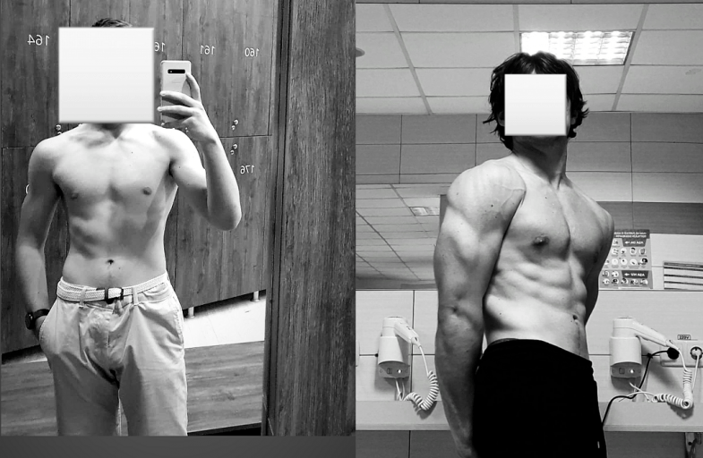 A progress pic of a 5'11" man showing a muscle gain from 155 pounds to 170 pounds. A net gain of 15 pounds.