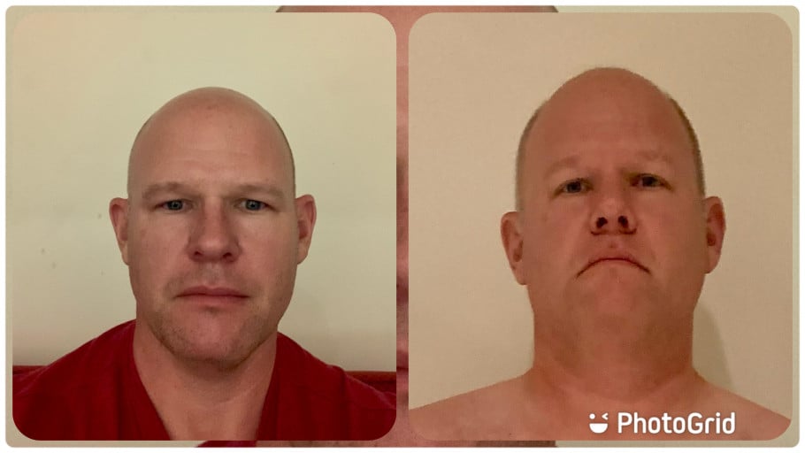 A picture of a 6'1" male showing a weight loss from 338 pounds to 220 pounds. A net loss of 118 pounds.