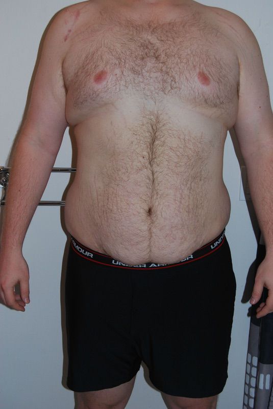 4 Photos of a 6 feet 6 314 lbs Male Weight Snapshot
