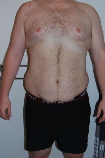 A progress pic of a person at 142 kg