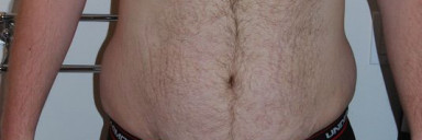 4 Photos of a 6 feet 6 314 lbs Male Weight Snapshot