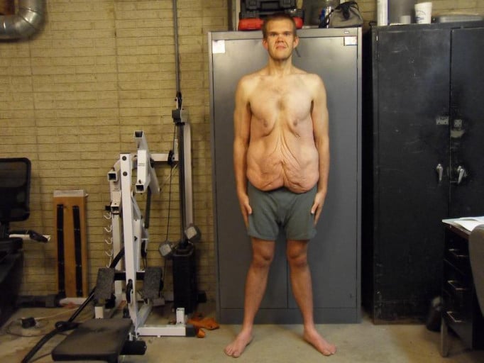 A progress pic of a 6'4" man showing a snapshot of 201 pounds at a height of 6'4