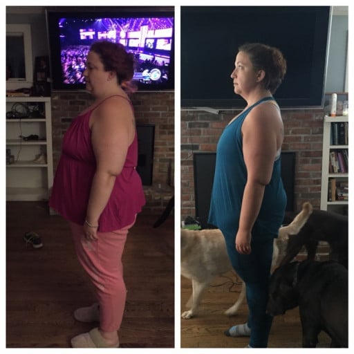 F/34/5'4 [284>219 = 65lbs] (4 months) Yes, I had surgery and I'm happy to discuss it!