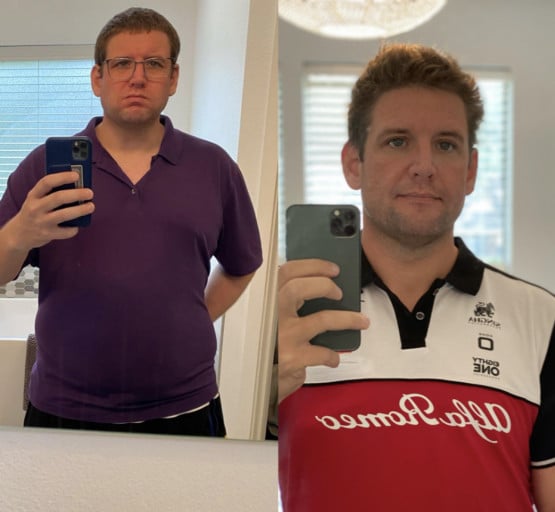 A before and after photo of a 6'2" male showing a weight reduction from 331 pounds to 229 pounds. A respectable loss of 102 pounds.