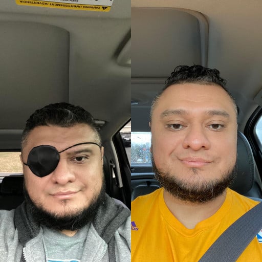 5 feet 7 Male Before and After 27 lbs Weight Loss 235 lbs to 208 lbs