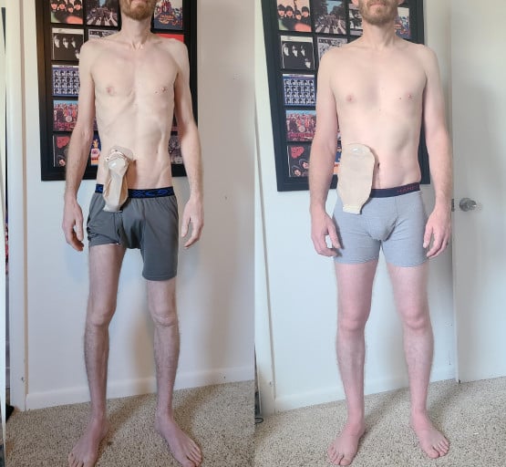 A before and after photo of a 5'10" male showing a weight bulk from 116 pounds to 160 pounds. A respectable gain of 44 pounds.
