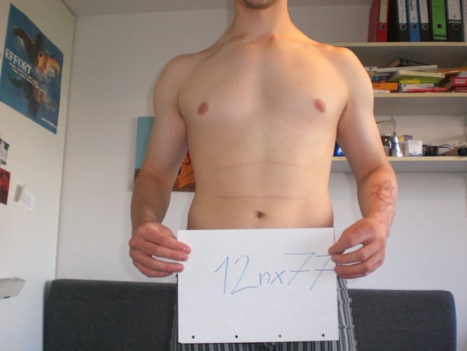 A 25 Year Old Man's Advanced Weight Loss Journey: From 180Lbs to ??