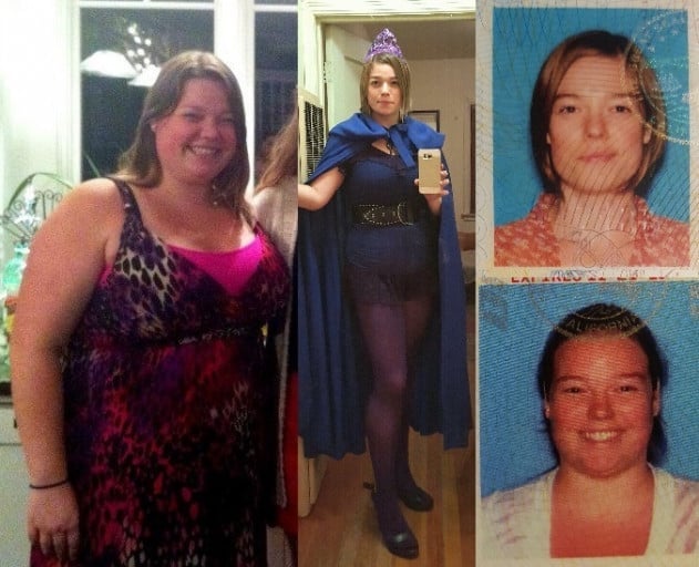 A before and after photo of a 5'5" female showing a weight reduction from 250 pounds to 149 pounds. A total loss of 101 pounds.