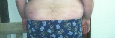 4 Pictures of a 5 foot 10 385 lbs Male Weight Snapshot