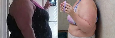 5 feet 7 Female Before and After 100 lbs Weight Loss 350 lbs to 250 lbs