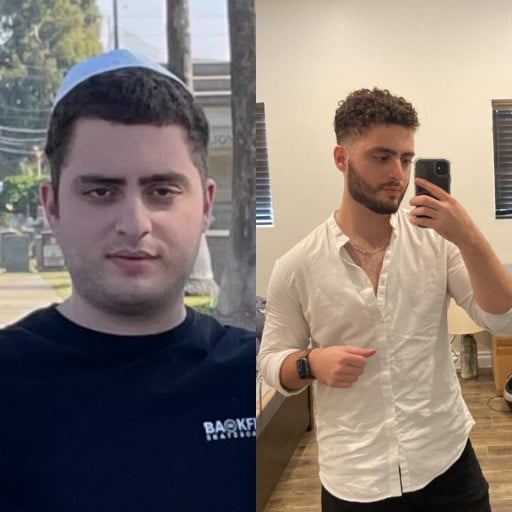 A before and after photo of a 5'9" male showing a weight reduction from 195 pounds to 165 pounds. A total loss of 30 pounds.