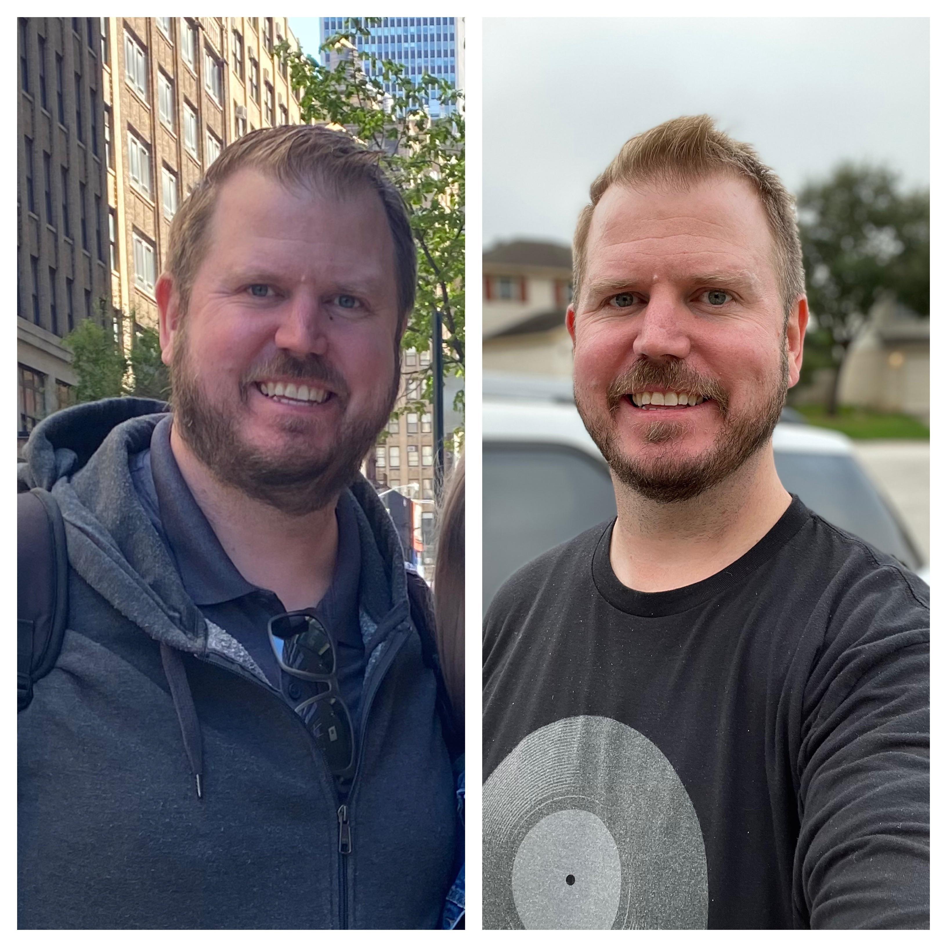 6'5 Male Progress Pics of 75 lbs Fat Loss 358 lbs to 283 lbs
