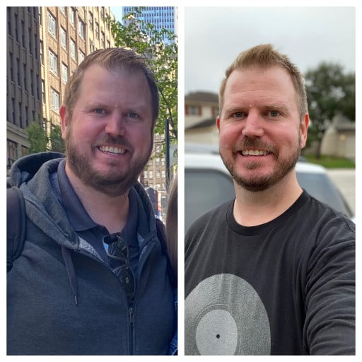 6 foot 5 Male 75 lbs Weight Loss Before and After 358 lbs to 283 lbs