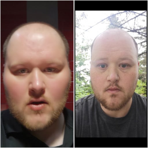 A progress pic of a 6'3" man showing a fat loss from 400 pounds to 230 pounds. A total loss of 170 pounds.