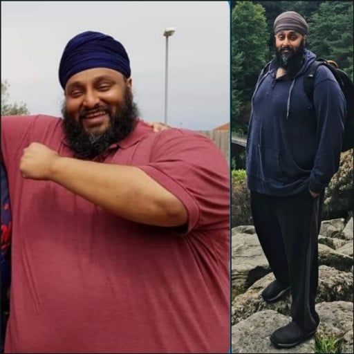 150 lbs Weight Loss Before and After 5'9 Male 460 lbs to 310 lbs