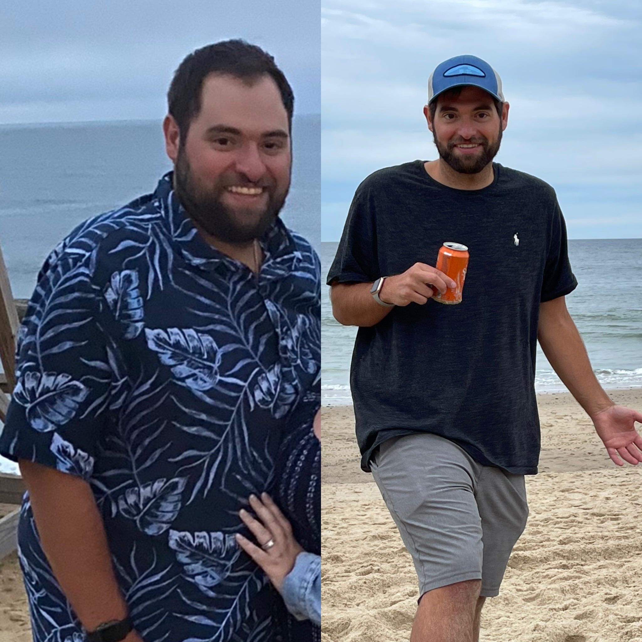Progress Pics of 100 lbs Weight Loss 5'10 Male 307 lbs to 207 lbs