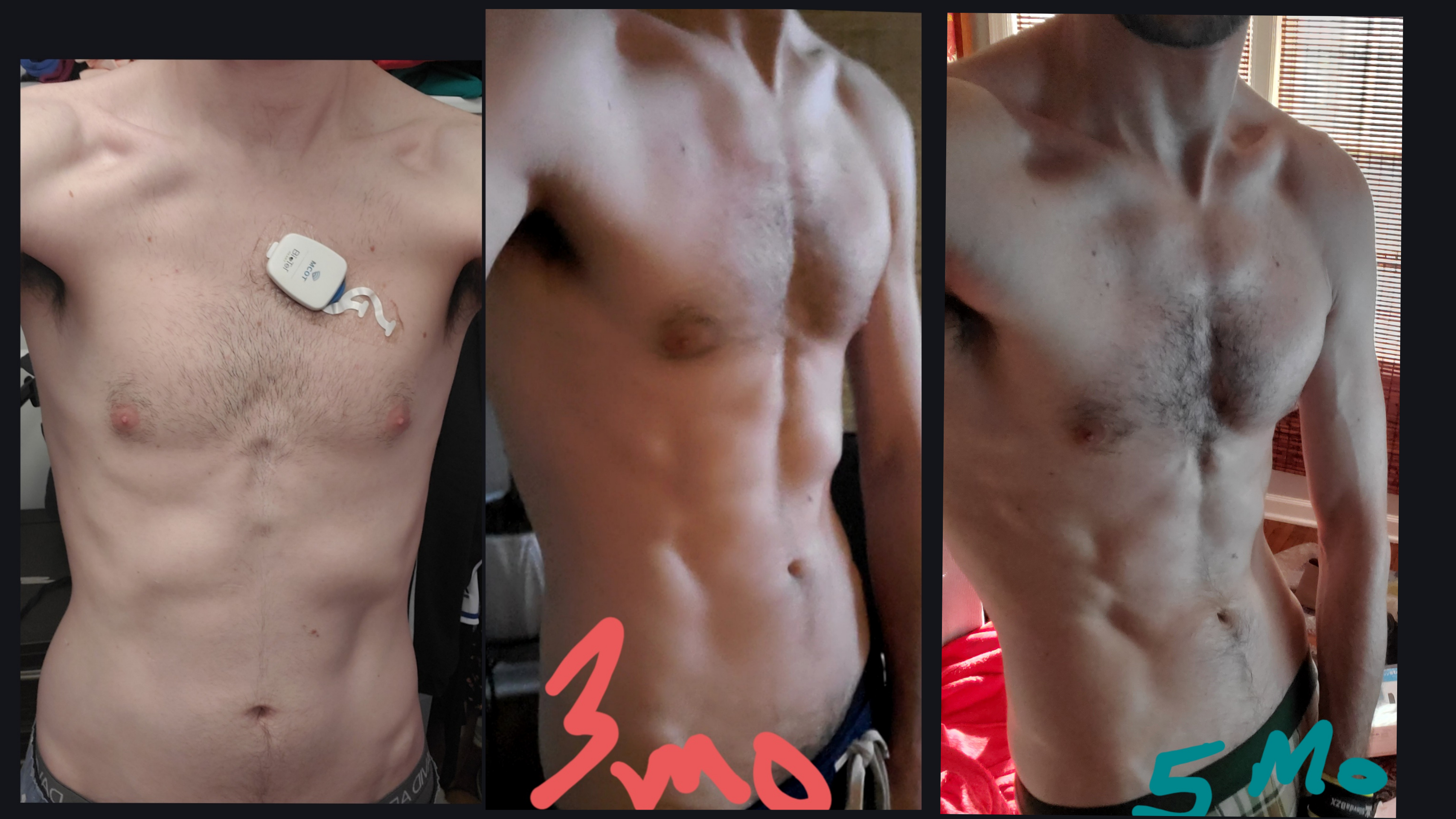 22 lbs Weight Gain 6 foot Male 115 lbs to 137 lbs