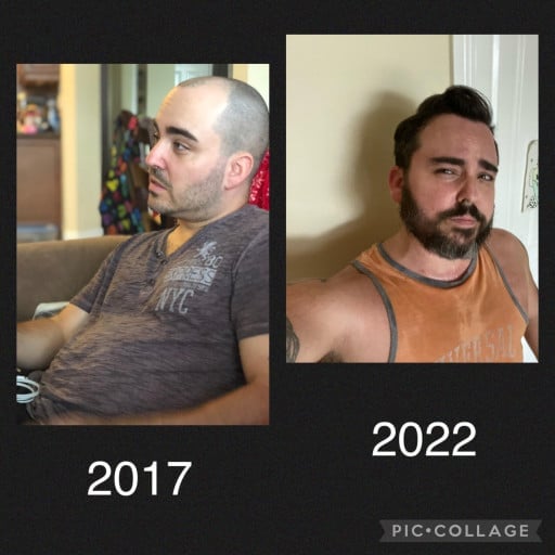 20 lbs Fat Loss Before and After 5 feet 7 Male 198 lbs to 178 lbs